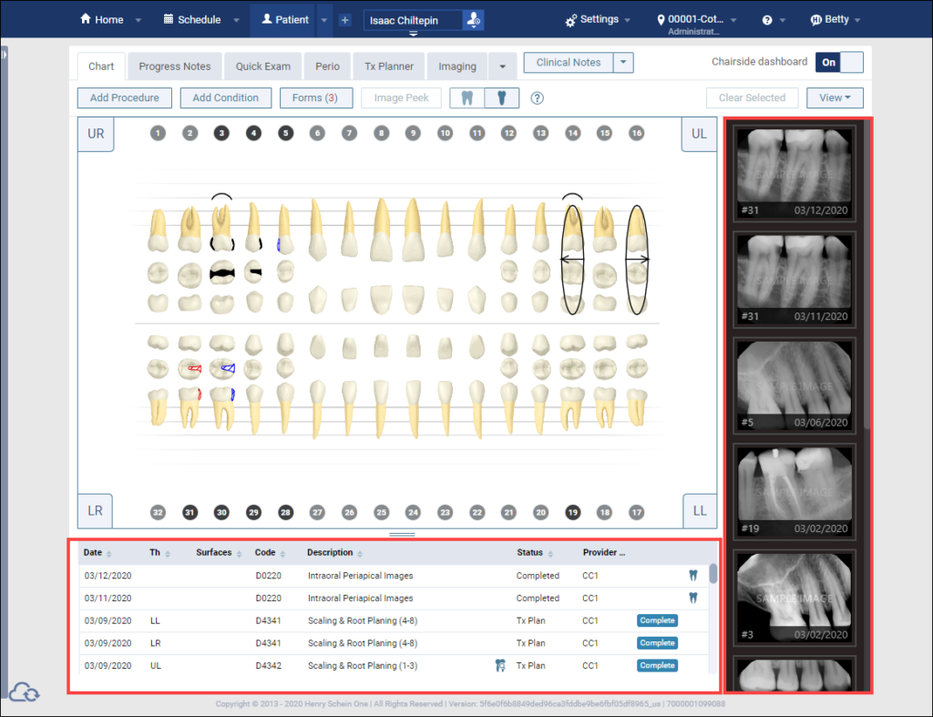 dentrix xray screenshot